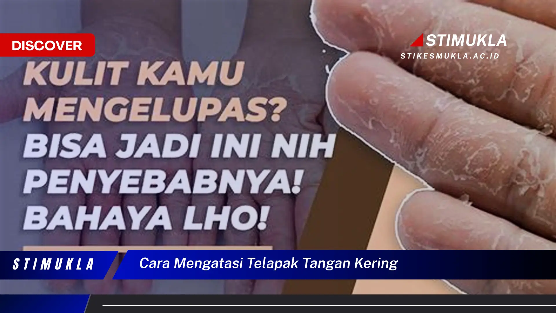 Ketahui Cara Atasi Telapak Tangan Kering yang Jarang Diketahui