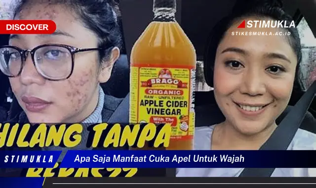 apa saja manfaat cuka apel untuk wajah