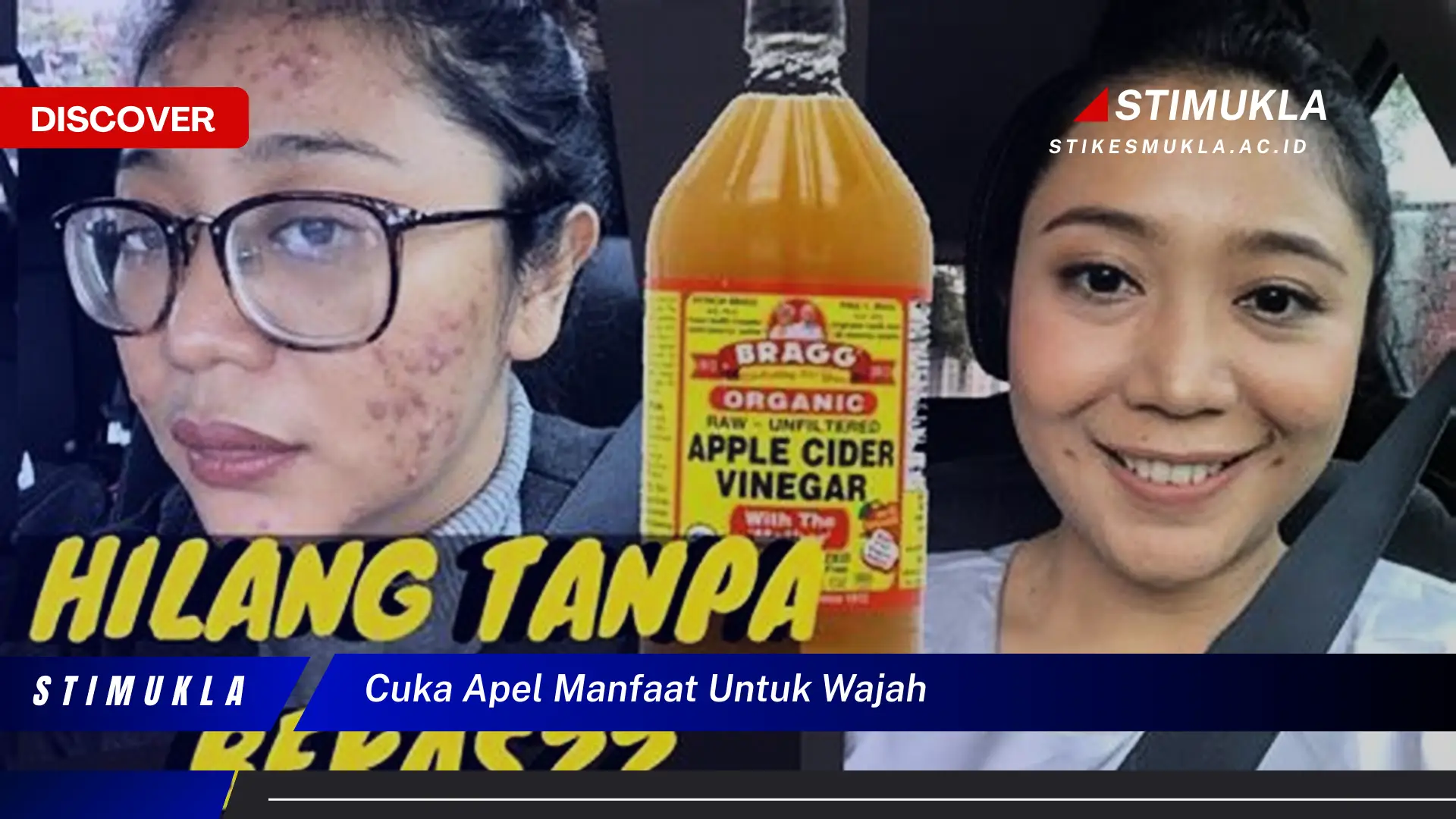 cuka apel manfaat untuk wajah