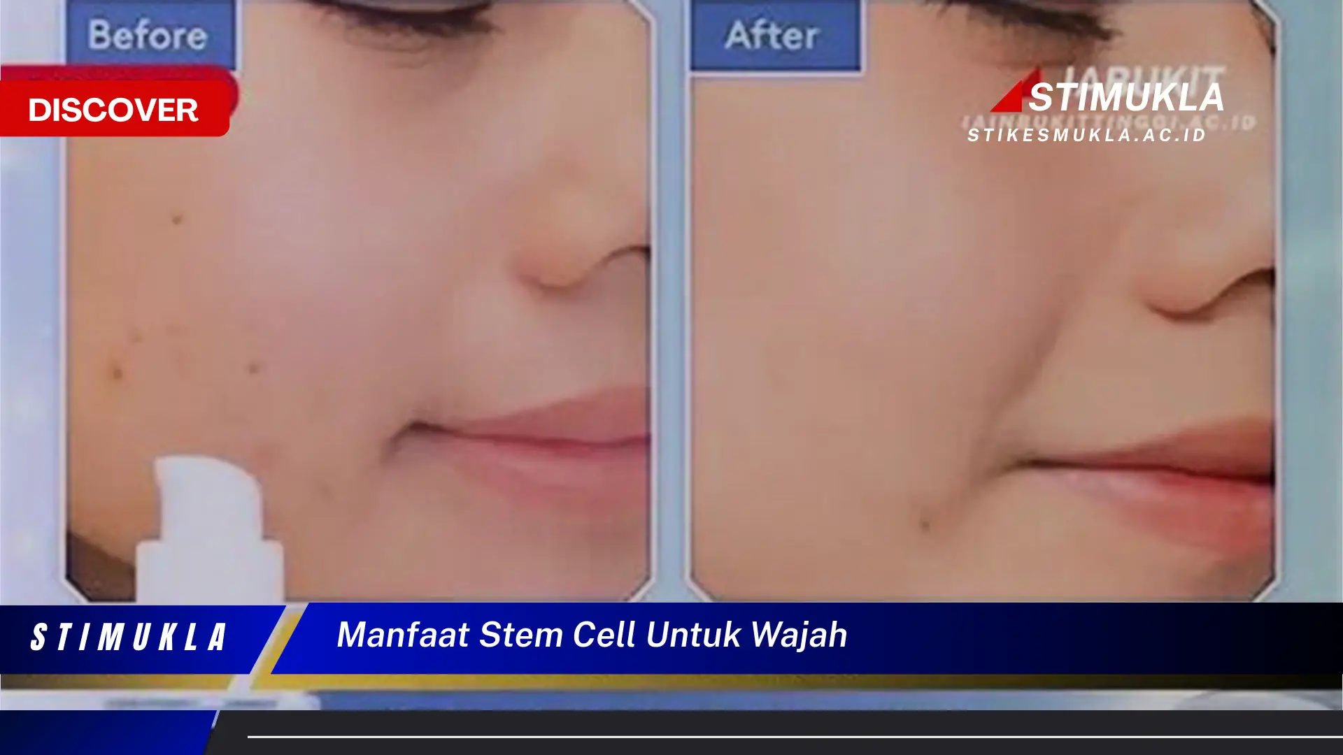 manfaat stem cell untuk wajah