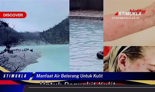 Inilah 8 Manfaat Air Belerang untuk Kulit  Atasi Jerawat dan Gatal