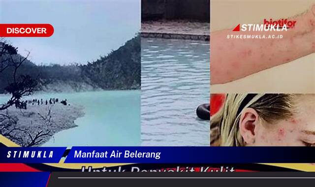 Ketahui 9 Manfaat Air Belerang untuk Kulit, Atasi Jerawat, Eksim, dan Masalah Kulit Lainnya Ketahui 9 Manfaat Air Belerang untuk Kulit, Atasi Jerawat, Eksim, dan Masalah Kulit Lainnya