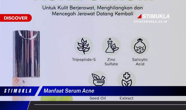 Ketahui 9 Manfaat Serum Acne untuk Kulit Berjerawat dan Cara Mendapatkannya Dengan Cepat