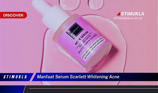Ketahui 10 Manfaat Serum Scarlett Whitening Acne untuk Kulit Berjerawat dan Cerah Ketahui 10 Manfaat Serum Scarlett Whitening Acne untuk Kulit Berjerawat dan Cerah